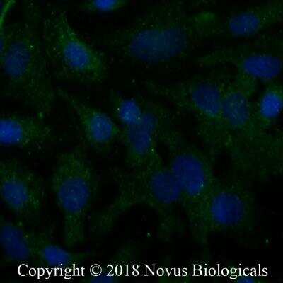 Immunocytochemistry/Immunofluorescence: CXCL13/BLC/BCA-1 Antibody [NBP2-16041] - HepG2 cells were fixed for 10 minutes using 10% formalin and then permeabilized for 5 minutes using 1X PBS + 0.05% Triton X-100. The cells were incubated with anti-CXCL13 at 5 ug/ml overnight at 4C and detected with an anti-rabbit Dylight 488 (Green) at a 1:500 dilution. Nuclei were counterstained with DAPI (Blue). Cells were imaged using a 40X objective.