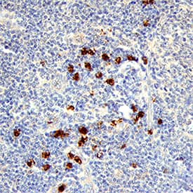 CXCL16 was detected in immersion fixed paraffin-embedded sections of human lymphoma tissue using Goat Anti-Human/Primate CXCL16 Biotinylated Antigen Affinity-purified Polyclonal Antibody (Catalog # BAF976) at 15 µg/mL overnight at 4 °C. Tissue was stained using the Anti-Goat HRP-DAB Cell & Tissue Staining Kit (brown; Catalog # CTS008) and counterstained with hematoxylin (blue). Specific staining was localized to cytoplasm in lymphocytes. View our protocol for Chromogenic IHC Staining of Paraffin-embedded Tissue Sections.