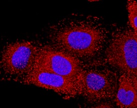 CXCL17/VCC-1 was detected in immersion fixed A549 human lung carcinoma cell line using Mouse Anti-Human CXCL17/VCC-1 Monoclonal Antibody (Catalog # MAB4207) at 10 µg/mL for 3 hours at room temperature. Cells were stained using the NorthernLights™ 557-conjugated Anti-Mouse IgG Secondary Antibody (red; Catalog # NL007) and counterstained with DAPI(blue). Specific staining was localized to cytoplasm. View our protocol for Fluorescent ICC Staining of Cells on Coverslips.