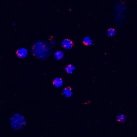 CXCL2/GRO beta /MIP-2/CINC-3 was detected in immersion fixed mouse splenocytes stimulated with LPS and monensin using Mouse CXCL2/GRO beta /MIP-2/CINC-3 Biotinylated Antigen Affinity-purified Polyclonal Antibody (Catalog # BAF452) at 10 µg/mL for 3 hours at room temperature. Cells were stained using the NorthernLights™ 557-conjugated Streptavidin (red; Catalog # NL999) and counterstained with DAPI (blue). Specific staining was localized to cytoplasm. View our protocol for Fluorescent ICC Staining of Non-adherent Cells.