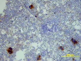 CXCL2/GRO beta /MIP-2/CINC-3 was detected in immersion fixed frozen sections of mouse spleen using Mouse CXCL2/GRO beta /MIP-2/CINC-3 Biotinylated Antigen Affinity-purified Polyclonal Antibody (Catalog # BAF452) at 15 µg/mL overnight at 4 °C. Tissue was stained using the Anti-Goat HRP-DAB Cell & Tissue Staining Kit (brown; Catalog # CTS008) and counterstained with hematoxylin (blue). View our protocol for Chromogenic IHC Staining of Frozen Tissue Sections.