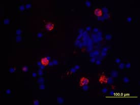 IL-8/CXCL8 was detected in immersion fixed PMA-, ionomycin- and monensin-activated human peripheral blood mononuclear cells (PBMCs) using Human IL-8/CXCL8 Biotinylated Antigen Affinity-purified Polyclonal Antibody (Catalog # BAF208) at 10 µg/mL for 3 hours at room temperature. Cells were stained using the NorthernLights™ 557-conjugated Streptavidin (red; Catalog # NL999) and counterstained with DAPI (blue). View our protocol for Fluorescent ICC Staining of Non-adherent Cells.