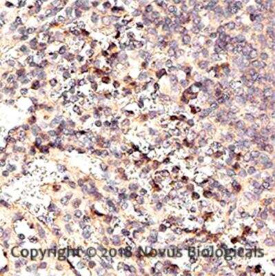 Immunohistochemistry-Paraffin: CXCR3 Antibody [NB100-56404] - IHC analysis of a FFPE human spleen using 1:25 dilution of CXCR3 antibody on a Bond Rx autostainer (Leica Biosystems). The assay involved 20 minutes of HIER using 10mM sodium citrate buffer (pH 6.0) and endogenous peroxidase quenching with peroxide block. The sections were incubated with primary antibody for 30 minutes and Bond Polymer Refine Detection (Leica Biosystems) with DAB was used for signal development followed by counterstaining with hematoxylin. Whole slide scanning and capturing of representative images (40X) was performed using Aperio AT2 (Leica Biosystems). Staining was performed by Histowiz.