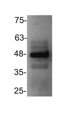 Western Blot: CXCR3 Antibody [NB100-56404] - HEK293T cells. Western blot image submitted by a verified customer review.