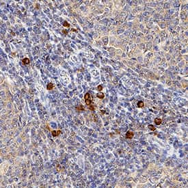     CXCR3  was detected in perfusion fixed paraffin-embedded sections of human tonsil  using Mouse Anti-Human CXCR3 Monoclonal Antibody (Catalog # MAB160R) at  0.5 µg/mL for 1 hour at room temperature followed by  incubation with the Anti-Mouse IgG VisUCyte™  HRP Polymer Antibody (Catalog #  VC001).  Tissue was stained using DAB (brown) and counterstained with hematoxylin  (blue).  Specific staining was  localized to infiltrating lymphocytes. View our protocol for IHC  Staining with VisUCyte HRP Polymer Detection Reagents. 