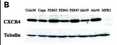 Western Blot: CXCR4 Antibody [NBP1-77067] - CXCR4 protein was detected in the human metastatic melanoma cell lines and human melanoma cell line (colo38), but not in the human primary melanocytes (MPR1) with anti-CXCR4 antibodies. 