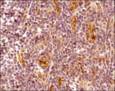 Immunohistochemistry-Paraffin: CXCR7/RDC-1 Antibody [NBP2-24779] - Analysis of a FFPE tissue section of human tonsil using 5ug/ml concentration of CXCR7/RDC-1 antibody. The staining was developed using HRP labeled anti-rabbit secondary antibody and DAB reagent, and nuclei of cells were counter-stained with hematoxylin. This CXCR7 antibody generated a specific membrane cytoplasmic staining in most of the cells, and the signal was highest/very intense in the endothelial cells/blood vessels.
