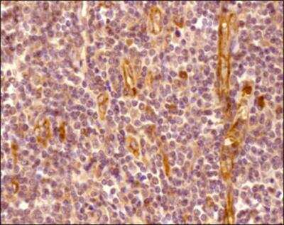 Immunohistochemistry-Paraffin: CXCR7/RDC-1 Antibody [NBP2-24779] - Analysis of a FFPE tissue section of human tonsil using 5ug/ml concentration of CXCR7/RDC-1 antibody. The staining was developed using HRP labeled anti-rabbit secondary antibody and DAB reagent, and nuclei of cells were counter-stained with hematoxylin. This CXCR7 antibody generated a specific membrane cytoplasmic staining in most of the cells, and the signal was highest/very intense in the endothelial cells/blood vessels.