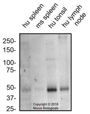 Western Blot: CXCR7/RDC-1 Antibody [NBP2-24779] - Total protein from human spleen, tonsil, lymph node and mouse spleen was separated on a 7.5% gel by SDS-PAGE, transferred to PVDF membrane and blocked in 5% non-fat milk in TBST. The membrane was probed with 2.0 ug/ml anti-CXCR7 in 1% BSA in TBST and detected with an anti-rabbit HRP secondary antibody using chemiluminescence.
