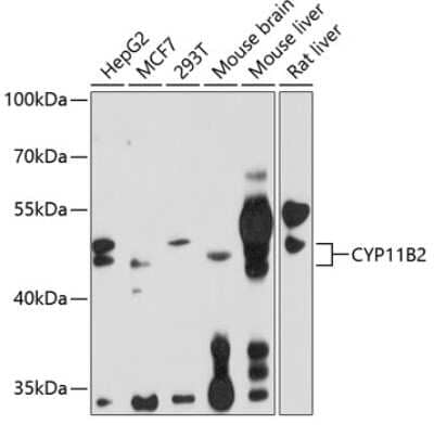 CYP11B2 Antibody (NBP2-92862): Novus Biologicals