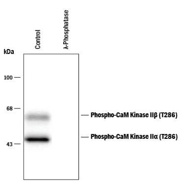 Western Blot of rat brain tissue lysate showing specific immunolabeling of the ~50 kDa  alpha -CaMKII subunit phosphorylated at T286 and the ~60 kDa  beta -CaMKII subunit phosphorylated at T287 (Control). The phosphospecificity of this labeling is demonstrated by treatment with 1200 U of  lambda  Phosphatase ( lambda -PPase) for 30 minutes before being exposed to the anti-phospho-CaMKII (T286). The immunolabeling is completely eliminated by treatment with  lambda -PPase.