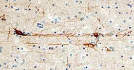 CaM Kinase IId was detected in immersion fixed paraffin-embedded sections of human brain (cerebral cortex) using 15 µg/mL Sheep Anti-Human CaM Kinase IId Antigen Affinity-purified Polyclonal Antibody (Catalog # AF4176) overnight at 4 °C. Tissue was stained with the Anti-Sheep HRP-DAB Cell & Tissue Staining Kit (brown; Catalog # CTS019) and counter-stained with hematoxylin (blue). View our protocol for Chromogenic IHC Staining of Paraffin-embedded Tissue Sections.