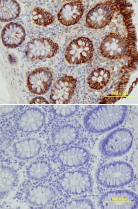 Cadherin-17 was detected in immersion fixed paraffin-embedded sections of human colon array using Goat Anti-Human Cadherin-17 Biotinylated Antigen Affinity-purified Polyclonal Antibody (Catalog # BAF1032) at 25 µg/mL overnight at 4 °C. Tissue was stained using the Anti-Goat HRP-DAB Cell & Tissue Staining Kit (brown; Catalog # CTS008) and counterstained with hematoxylin (blue). Lower panel shows a lack of labeling if primary antibodies are omitted and tissue is stained only with secondary antibody followed by incubation with detection reagents. View our protocol for Chromogenic IHC Staining of Paraffin-embedded Tissue Sections.