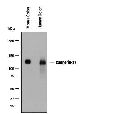 Western blot shows lysates of human colon tissue and mouse colon tissue. PVDF membrane was probed with 0.5 µg/mL of Goat Anti-Human Cadherin‑17 Antigen Affinity-purified Polyclonal Antibody (Catalog # AF1032) followed by HRP-conjugated Anti-Goat IgG Secondary Antibody (Catalog # HAF017). A specific band was detected for Cadherin‑17 at approximately 125 kDa (as indicated). This experiment was conducted under reducing conditions and using Immunoblot Buffer Group 1.