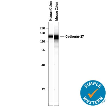   Simple  Western lane view shows lysates of human colon tissue and mouse colon tissue,  loaded at 0.2 mg/mL. Specific bands were detected for  Cadherin‑17 at approximately 152 and 146 kDa (as indicated)  using 1:100 dilution of Rabbit Anti-Human/Mouse Cadherin‑17  Antigen Affinity-purified Polyclonal Antibody (Catalog # AF8524) . This  experiment was conducted under reducing conditions and using the12-230 kDa separation system.        