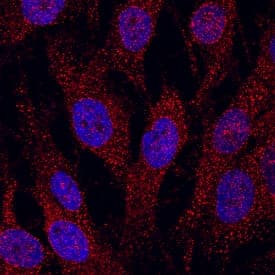 Cadherin-6/KCAD was detected in immersion fixed MG-63 human osteosarcoma cell line using Mouse Anti-Human Cadherin-6/KCAD Monoclonal Antibody (Catalog # MAB2715) at 10 µg/mL for 3 hours at room temperature. Cells were stained using the NorthernLights™ 557-conjugated Anti-Mouse IgG Secondary Antibody (red; Catalog # NL007) and counterstained with DAPI (blue). Specific staining was localized to cytoplasm. View our protocol for Fluorescent ICC Staining of Cells on Coverslips.