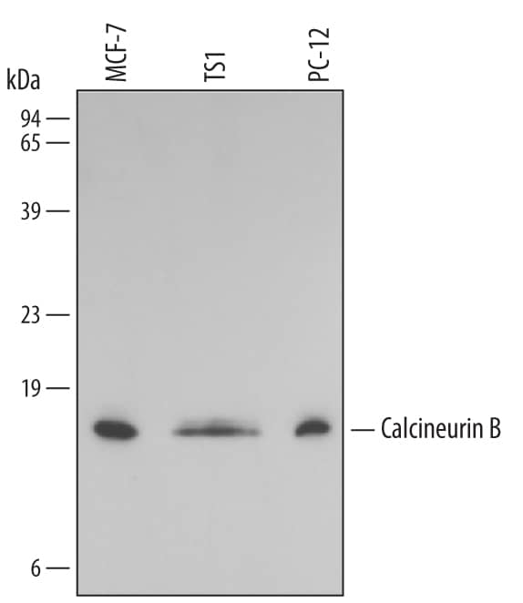 Western blot shows lysates of MCF-7 human breast cancer cell line, TS1 mouse helper T cell line, and PC-12 rat adrenal pheochromocytoma cell line. PVDF membrane was probed with 0.5 µg/mL of Human/Mouse/Rat Calcineurin B Monoclonal Antibody (Catalog # MAB1348) followed by HRP-conjugated Anti-Mouse IgG Secondary Antibody (Catalog # HAF007). A specific band was detected for Calcineurin B at approximately 18 kDa (as indicated). This experiment was conducted under reducing conditions and using Immunoblot Buffer Group 3.