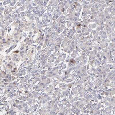 Immunohistochemistry-Paraffin: Calreticulin Antibody [NBP2-48491] - Staining of human pancreas shows low expression as expected.