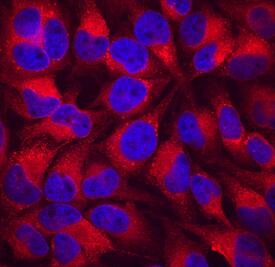 Calreticulin was detected in immersion fixed HeLa human cervical epithelial carcinoma cell line using Goat Anti-Human Calreticulin Antigen Affinity-purified Polyclonal Antibody (Catalog # AF3898) at 10 µg/mL for 3 hours at room temperature. Cells were stained using the Northern-Lights™ 557-conjugated Anti-Goat IgG Secondary Antibody (red; Catalog # NL001) and counterstained with DAPI (blue). Specific staining was localized to endoplasmic reticula. View our protocol for Fluorescent ICC Staining of Cells on Coverslips.