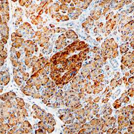 Calreticulin was detected in immersion fixed paraffin-embedded sections of human pancreas using Goat Anti-Human Calreticulin Antigen Affinity-purified Polyclonal Antibody (Catalog # AF3898) at 3 µg/mL overnight at 4 °C. Before incubation with the primary antibody, tissue was subjected to heat-induced epitope retrieval using Antigen Retrieval Reagent-Basic (Catalog # CTS013). Tissue was stained using the Anti-Goat HRP-DAB Cell & Tissue Staining Kit (brown; Catalog # CTS008) and counterstained with hematoxylin (blue). Specific staining was localized to islet cells. View our protocol for Chromogenic IHC Staining of Paraffin-embedded Tissue Sections.