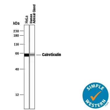 Simple Western lane view shows lysates of HeLa human cervical epithelial carcinoma cell line and human adrenal gland tissue, loaded at 0.2 mg/mL. A specific band was detected for Calreticulin at approximately 63 kDa (as indicated) using 10 µg/mL of Goat Anti-Human Calreticulin Antigen Affinity-purified Polyclonal Antibody (Catalog # AF3898) followed by 1:50 dilution of HRP-conjugated Anti-Goat IgG Secondary Antibody (Catalog # HAF109). This experiment was conducted under reducing conditions and using the 12‑230 kDa separation system. 