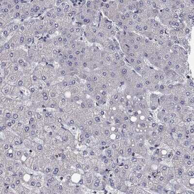 Calsyntenin-1 Antibody (NBP3-17025): Novus Biologicals