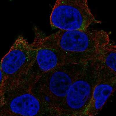 Carbonic Anhydrase XIV/CA14 Antibody (NBP1-87477): Novus Biologicals