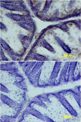 Carbonic Anhydrase IV was detected in perfusion fixed frozen sections of mouse small intestine using Mouse Carbonic Anhydrase IV Monoclonal Antibody (Catalog # MAB2414) at 25 µg/mL overnight at 4 °C. Tissue was stained using the Anti-Rat HRP-DAB Cell & Tissue Staining Kit (brown; Catalog # CTS017) and counterstained with hematoxylin (blue). Lower panel shows a lack of labeling if primary antibodies are omitted and tissue is stained only with secondary antibody followed by incubation with detection reagents. Specific staining was localized to nuclei, cell surfaces and cytoplasm. View our protocol for Chromogenic IHC Staining of Frozen Tissue Sections.