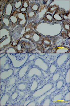 Carbonic Anhydrase IV was detected in perfusion fixed frozen sections of mouse kidney using Mouse Carbonic Anhydrase IV Monoclonal Antibody (Catalog # MAB2414) at 25 µg/mL overnight at 4 °C. Tissue was stained using the Anti-Rat HRP-DAB Cell & Tissue Staining Kit (brown; Catalog # CTS017) and counterstained with hematoxylin (blue). Lower panel shows a lack of labeling if primary antibodies are omitted and tissue is stained only with secondary antibody followed by incubation with detection reagents. Specific staining was localized to cell surfaces and cytoplasm. View our protocol for Chromogenic IHC Staining of Frozen Tissue Sections.