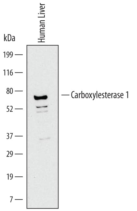 Western blot shows lysates of human liver tissue. PVDF Membrane was probed with 2 µg/mL of Mouse Anti-Human Carboxylesterase 1/CES1 Monoclonal Antibody (Catalog # MAB4920) followed by HRP-conjugated Anti-Mouse IgG Secondary Antibody (Catalog # HAF007). A specific band was detected for Carboxylesterase 1/CES1 at approximately 70 kDa (as indicated). This experiment was conducted under reducing conditions and using Immunoblot Buffer Group 1.