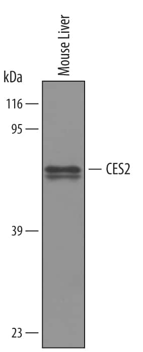 Western blot shows lysates of mouse liver tissue. PVDF membrane was probed with 1 µg/mL of Goat Anti-Mouse Carboxylesterase 2/CES2 Antigen Affinity-purified Polyclonal Antibody (Catalog # AF5280) followed by HRP-conjugated Anti-Goat IgG Secondary Antibody (Catalog # HAF019). A specific band was detected for Carboxylesterase 2/CES2 at approximately 58-62 kDa (as indicated). This experiment was conducted under reducing conditions and using Immunoblot Buffer Group 8.