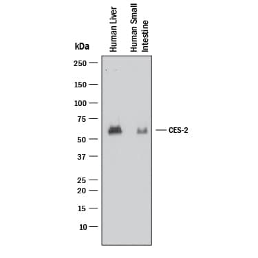 Western blot shows lysates of human liver tissue and human small intestine tissue. PVDF membrane was probed with 2 µg/mL of Mouse Anti-Human Carboxylesterase 2/CES2 Monoclonal Antibody (Catalog # MAB56571) followed by HRP-conjugated Anti-Mouse IgG Secondary Antibody (HAF018). A specific band was detected for Carboxylesterase 2/CES2 at approximately 64 kDa (as indicated). This experiment was conducted under reducing conditions and using Immunoblot Buffer Group 1.