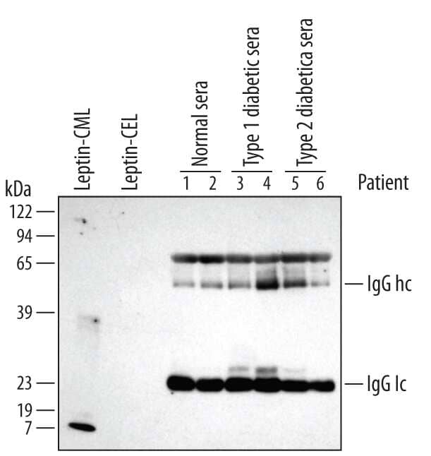 Western blot shows 100-fold diluted samples of sera from control, Type 1 diabetic, and Type 2 diabetic volunteers. PVDF membrane was probed with 1 µg/mL Carboxymethyl Lysine Monoclonal Antibody (Catalog # MAB3247) followed by HRP-conjugated Anti-Mouse IgG Secondary Antibody (Catalog # HAF007). Greater band intensity for the IgG heavy chain (IgG hc) suggests increased glycation in diabetic sera. For additional reference, carboxymethyl lysine-adducted (CML) Leptin and carboxyethyl lysine-adducted (CEL) Leptin were included. A specific band for CML-adducted Leptin was detected (as indicated). This experiment was conducted under reducing conditions using Immunoblot Buffer Group 1.