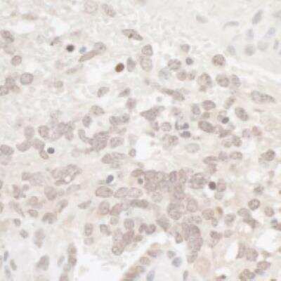 Immunohistochemistry-Paraffin: Casein Kinase 2 alpha Antibody [NB100-377] - Mouse teratoma. Antibody: Affinity purified rabbit anti-CKII Alpha used at a dilution of 1:1,000 (1ug/ml). Detection: DAB