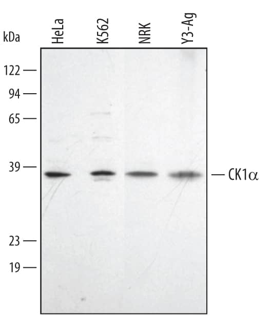 Western Blot Casein Kinase 1 alpha Antibody [Unconjugated]