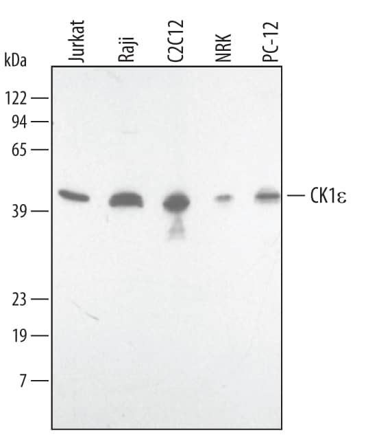 Western blot shows lysates of Jurkat human acute T cell leukemia cell line, Raji human Burkitt's lymphoma cell line, C2C12 mouse myoblast cell line, NRK rat normal kidney cell line, and PC-12 rat adrenal pheochromocytoma cell line. PVDF membrane was probed with 1 µg/mL of Human/Mouse/Rat Casein Kinase 1e Antigen Affinity-purified Polyclonal Antibody (Catalog # AF4567) followed by HRP-conjugated Anti-Sheep IgG Secondary Antibody (Catalog # HAF016). A specific band was detected for Casein Kinase 1 epsilon at approximately 47 kDa (as indicated). This experiment was conducted using Immunoblot Buffer Group 1.