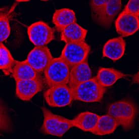 Casein Kinase 2 beta  was detected in immersion fixed Neuro-2A mouse neuroblastoma cell line using Sheep Anti-Human/Mouse/Rat Casein Kinase 2 beta  Antigen Affinity-purified Polyclonal Antibody (Catalog # AF4380) at 10 µg/mL for 3 hours at room temperature. Cells were stained using the NorthernLights™ 557-conjugated Anti-Sheep IgG Secondary Antibody (red; Catalog # NL010) and counterstained with DAPI (blue). Specific staining was localized to cytoplasm. View our protocol for Fluorescent ICC Staining of Cells on Coverslips.