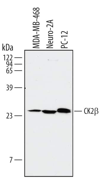 Western Blot Casein Kinase 2 beta Antibody [Unconjugated]