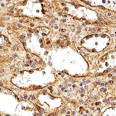 Immunohistochemistry-Paraffin: Caspase-10/FLICE2 Antibody - Unpurified [NB100-56124] - Caspase-10/FLICE2 Antibody [NB100-56124] - Caspase 10 was detected in immersion fixed paraffin-embedded sections of human spleen using this antibody at 1:1000 for 1 hour at room temperature followed by incubation with the Anti-Rabbit IgG VisUCyte™ HRP Polymer Antibody (Catalog # VC003). Tissue was stained using DAB (brown) and counterstained with hematoxylin (blue). Specific staining was localized to the cytoplasm and plasma membrane in splenocytes.