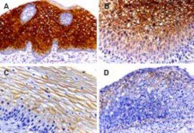 Immunohistochemistry-Paraffin: Caspase-14 Antibody [NB100-56126] - Tissue sections of human cervix stained  using this antibody at 1:2000. A. Normal cervix (squamous epithelium). B. CIN1 (low-grade squamous intraepithelial lesion, mild dysplasia). C. CIN2 (high-grade squamous intraepithelial lesion, moderate dysplasia. D. CIN3 (high-grade squamous intraepithelial lesion; severe dysplasia-carcinoma in situ. In normal cervi, caspase-14 staining was found most in the midzone layer, but was absent from the basal/parabasal cell layer where mitotically active cells are known to reside. This suggests induction of caspase-14 expression with differentiation. Caspase-14 expression declined progressively during malignant transformation as the histologic severity of the cervical atypia advanced from CIN1 to CIN3. Hematoxylin-eosin counterstain.