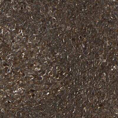 Immunohistochemistry-Paraffin: Caspase-8 Antibody [NBP1-88184] - Staining of human tonsil shows strong cytoplasmic positivity in germinal center cells and non-germinal center cells.