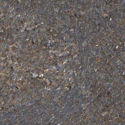 Immunohistochemistry-Paraffin: Caspase-8 Antibody [NBP1-88185] - Staining of human tonsil shows moderate cytoplasmic positivity in germinal center and non-germinal center cells.