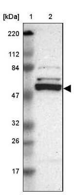 Western Blot: Caspase-8 Antibody [NBP1-88184] - Lane 1: Marker  [kDa] 220, 112, 84, 47, 32, 26, 17.  Lane 2: Human cell line RT-4