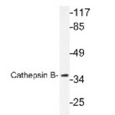 Cathepsin B Antibodies: Novus Biologicals