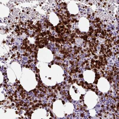 Immunohistochemistry-Paraffin: Cathepsin G Antibody [NBP2-33498] - Staining of human bone marrow shows strong cytoplasmic positivity in hematopoietic cells.