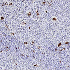 Cathepsin S was detected in immersion fixed paraffin-embedded sections of human lymph node using Goat Anti-Human Cathepsin S Biotinylated Antigen Affinity-purified Polyclonal Antibody (Catalog # BAF1183) at 15 µg/mL overnight at 4 °C. Tissue was stained using the Anti-Goat HRP-DAB Cell & Tissue Staining Kit (brown; Catalog # CTS008) and counterstained with hematoxylin (blue). Specific staining was localized to cytoplasm in lymphocytes. View our protocol for Chromogenic IHC Staining of Paraffin-embedded Tissue Sections.