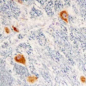 Cerebellin-2 was detected in immersion fixed paraffin-embedded sections of human brain (medulla) using Mouse Anti-Human Cerebellin-2 Monoclonal Antibody (Catalog # MAB70441) at 15 µg/mL overnight at 4 °C. Tissue was stained using the Anti-Mouse HRP-DAB Cell & Tissue Staining Kit (brown; Catalog # CTS002) and counterstained with hematoxylin (blue). Specific staining was localized to neuronal cell bodies. View our protocol for Chromogenic IHC Staining of Paraffin-embedded Tissue Sections.