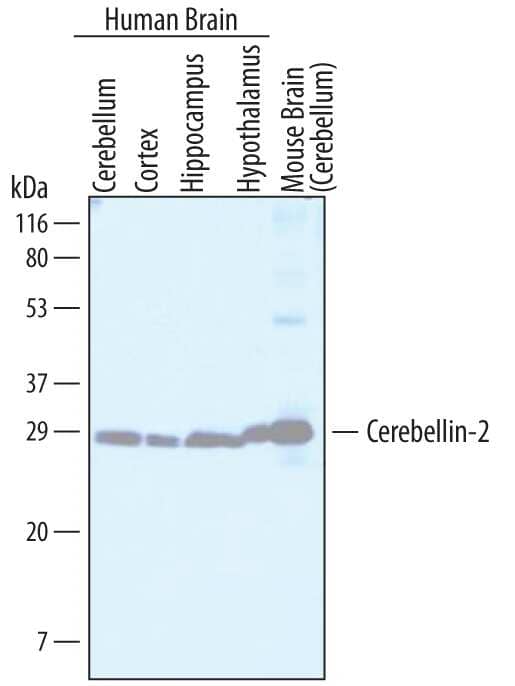 Western blot shows lysates of human brain (cerebellum) tissue, human brain (cortex) tissue, human brain (hippocampus) tissue, human brain (hypothalamus) tissue, and mouse brain (cerebellum) tissue. PVDF membrane was probed with 2 µg/mL of Mouse Anti-Human Cerebellin-2 Monoclonal Antibody (Catalog # MAB7044) followed by HRP-conjugated Anti-Mouse IgG Secondary Antibody (Catalog # HAF007). A specific band was detected for Cerebellin-2 at approximately 25 kDa (as indicated). This experiment was conducted under reducing conditions and using Immunoblot Buffer Group 1.