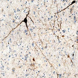 Immunohistochemistry Cerebellin-4 Antibody