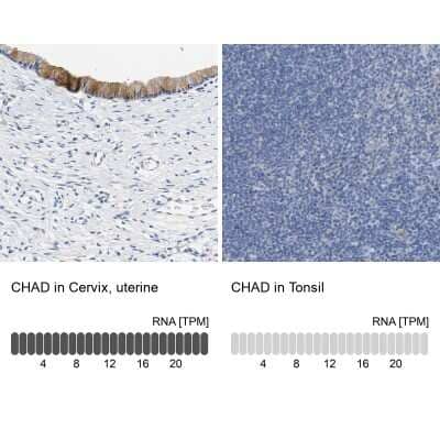 Immunohistochemistry-Paraffin: Chondroadherin Antibody [NBP1-87031] - Staining in human cervix, uterine and tonsil tissues using anti-CHAD antibody. Corresponding CHAD RNA-seq data are presented for the same tissues.